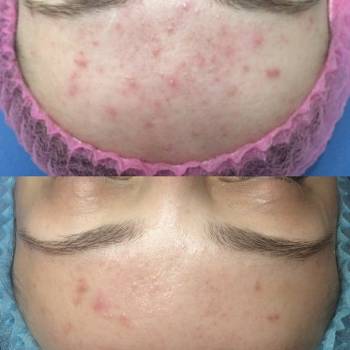 Фото с портфолио Юлия 