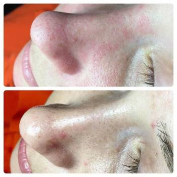 Татьяна Трофименко , Запорожье Фото - 5