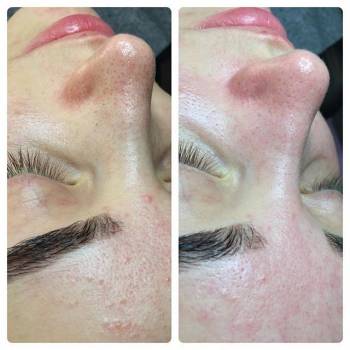 Татьяна Трофименко , Запорожье Фото - 8