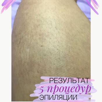 LASERLAB, Запорожье Фото - 8