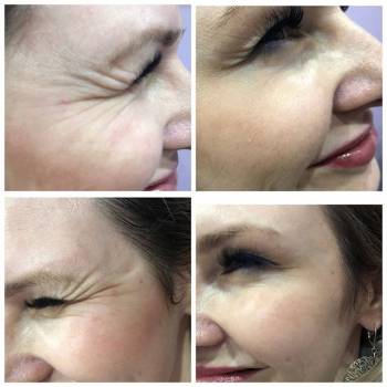 Фото с портфолио Crio Life