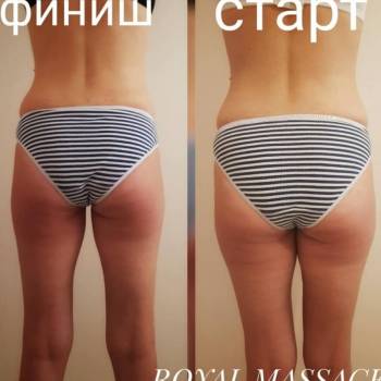 Фото с портфолио Royal Massage