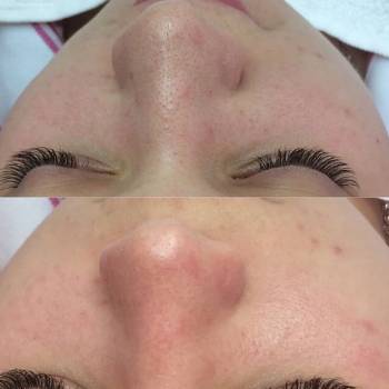 Фото с портфолио Лариса 