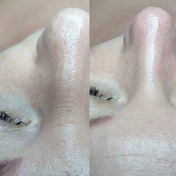 Фото с портфолио Лариса 