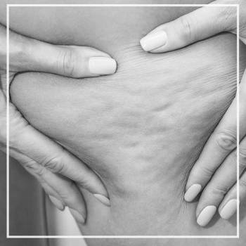 Фото с портфолио LPG My Body