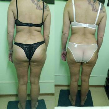 Фото с портфолио Анна Чипиленко