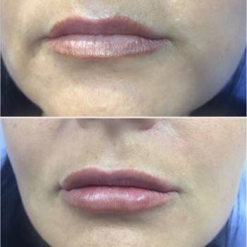 Фото с портфолио Оксана Богомолова 