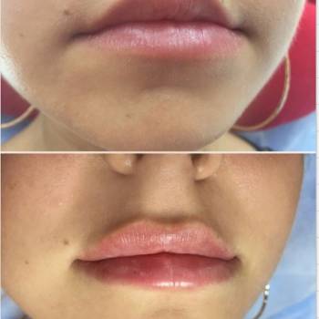 Фото с портфолио Оксана Богомолова 