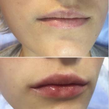 Фото с портфолио Оксана Богомолова 