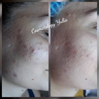 Фото с портфолио Юлия Галунова 