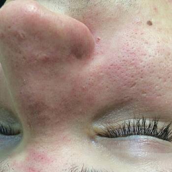 Фото с портфолио Лубская Екатерина 