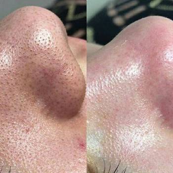 Фото с портфолио Лубская Екатерина 