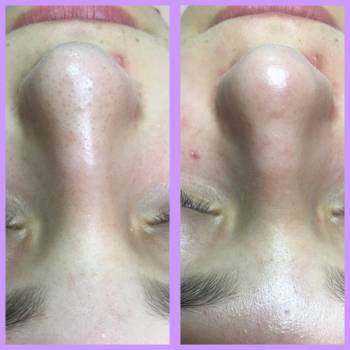 Кристина Хаевская , Винница Фото - 9