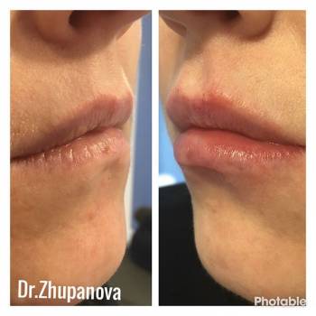 Жупанова Людмила , Винница Фото - 8