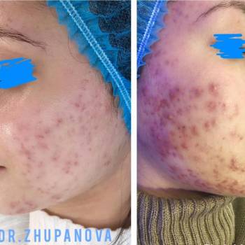 Жупанова Людмила , Винница Фото - 9