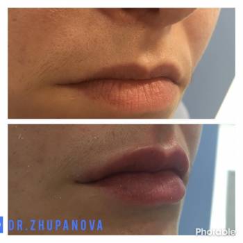 Жупанова Людмила , Винница Фото - 10