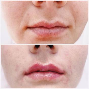 Анастасия Жаркая , Киев Фото - 2