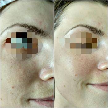 Елена Адаманова , Киев Фото - 11