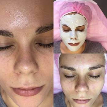 Чистка+уход