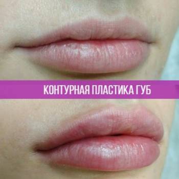 Дарина Самойлова , Київ Фото - 5