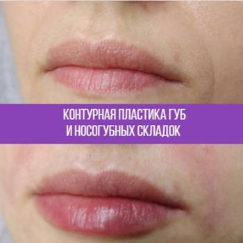 Дарина Самойлова , Київ Фото - 7