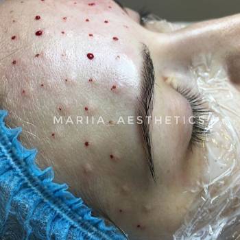 Фото с портфолио Мария 