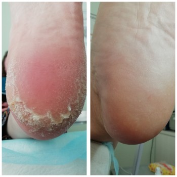 Подолог Львов
                    Подолог Юлия Кубышкина Львов