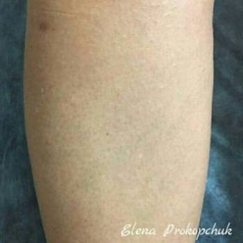 Елена Прокопчук, Одеса Фото - 5