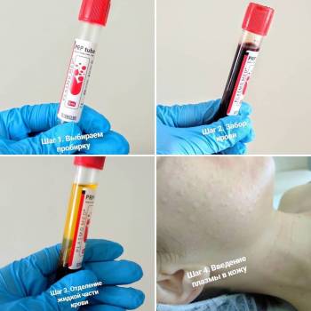 Тамара Поддубная , Вінниця Фото - 16