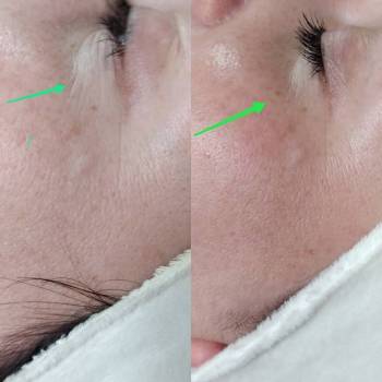 Елена , Винница Фото - 5