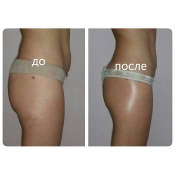 Фото с портфолио Анна Королева 