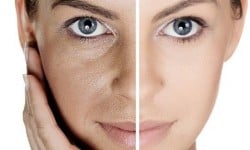 Ретиноловый пилинг Косметологічний центр O.L.Beauty Київ