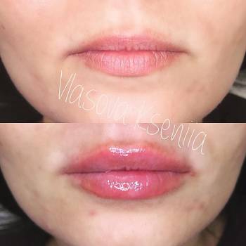 Фото с портфолио Ксения Власова 