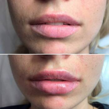 Виктория Рожнова , Одеса Фото - 5