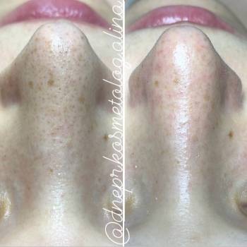 Алина Кандыбка , Дніпро Фото - 7