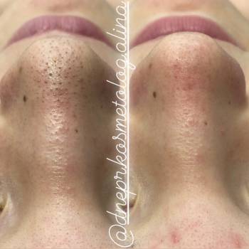 Алина Кандыбка , Дніпро Фото - 8