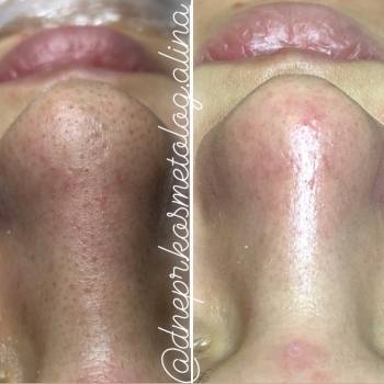 Алина Кандыбка , Дніпро Фото - 9