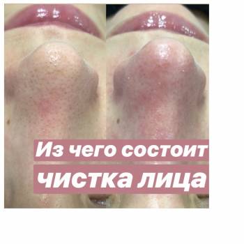 Алина Кандыбка , Дніпро Фото - 10