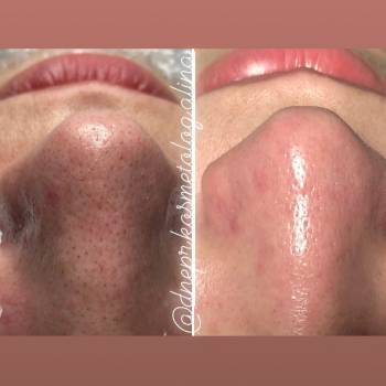 Алина Кандыбка , Дніпро Фото - 11