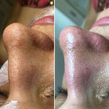 Алина Кандыбка , Дніпро Фото - 12