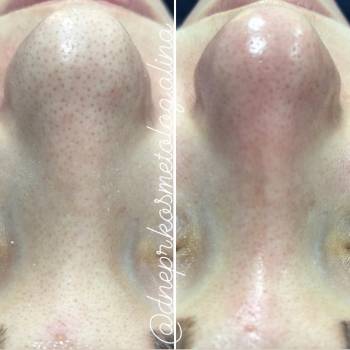 Алина Кандыбка , Дніпро Фото - 14