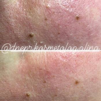 Алина Кандыбка , Дніпро Фото - 15