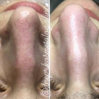 Алина Кандыбка , Дніпро Фото - 16