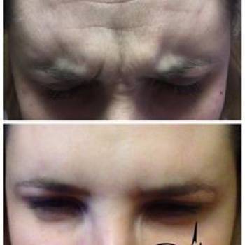 Анна Доля , Кривий Ріг Фото - 6