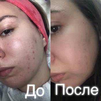 Фото с портфолио Блудилина Анна 