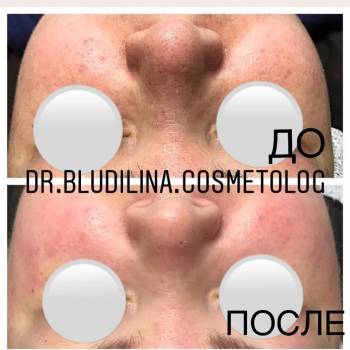 Фото с портфолио Блудилина Анна 