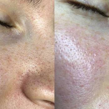 Фото с портфолио Блудилина Анна 