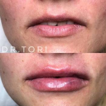 Фото с портфолио Виктория Кузнецова 