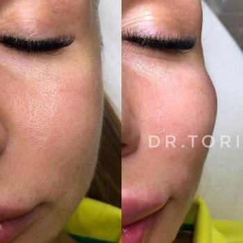 Фото с портфолио Виктория Кузнецова 