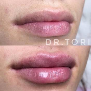 Фото с портфолио Виктория Кузнецова 